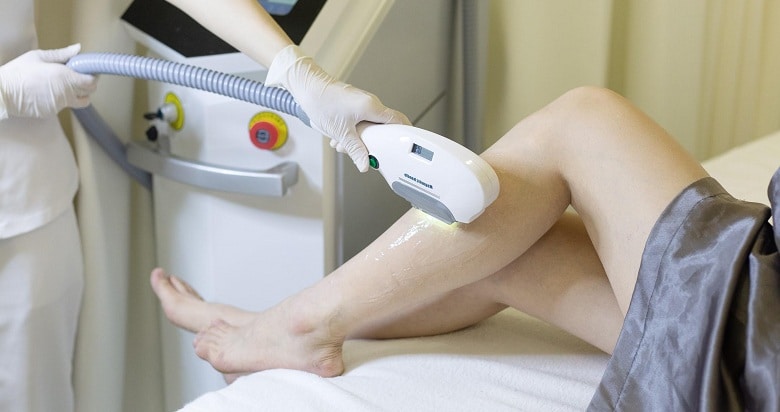 cách triệt lông vĩnh viễn